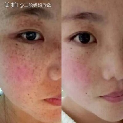 彩虹团队颜面膜创始人