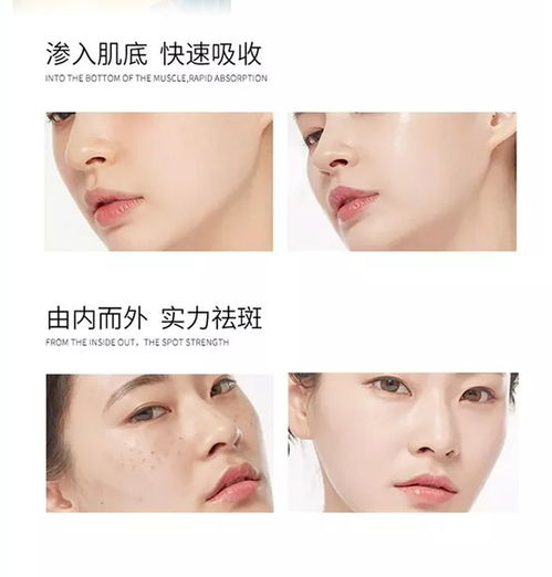 保湿祛斑霜正品黄褐斑雀斑晒斑妊娠斑老年斑各种色斑祛斑特证产品