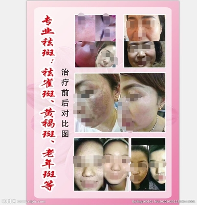 美容海报设计图__PSD分层素材_PSD分层素材_设计图库