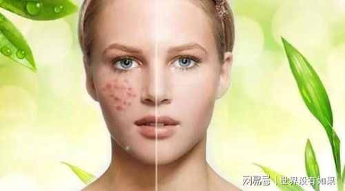 淡斑效果好的护肤品,很服气 黄褐斑用什么护肤品好