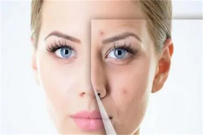 纯中药祛痘祛斑美白费多少钱?利润如何