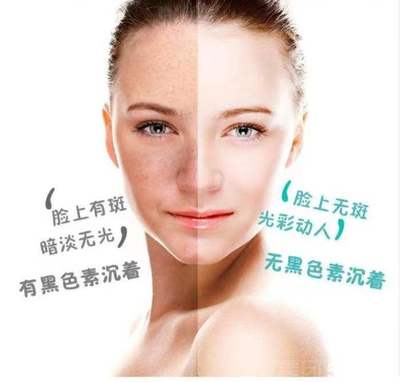 廊坊广阳河北工业大学周边专业祛红血丝服务 价格与联系方式解析