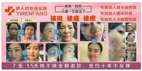 奕后美容 专业祛斑，让肌肤重焕光彩