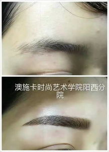 祛斑祛痘新篇章 庆祝翌芙莱专业祛斑祛痘阳西总店盛大开业