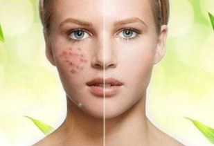 专业祛斑祛痘加盟连锁项目 开启美丽事业，共创健康肌肤未来