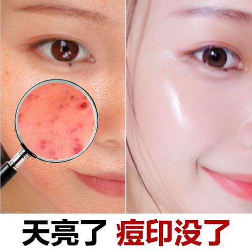 美白祛斑去痘印，素颜霜神仙膏让肌肤焕然一新