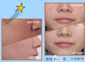 郄美芳——苏州姑苏区医颜美佳网专业祛斑专家