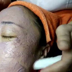 专业祛斑祛痘技术研究 科学护肤与实用指南