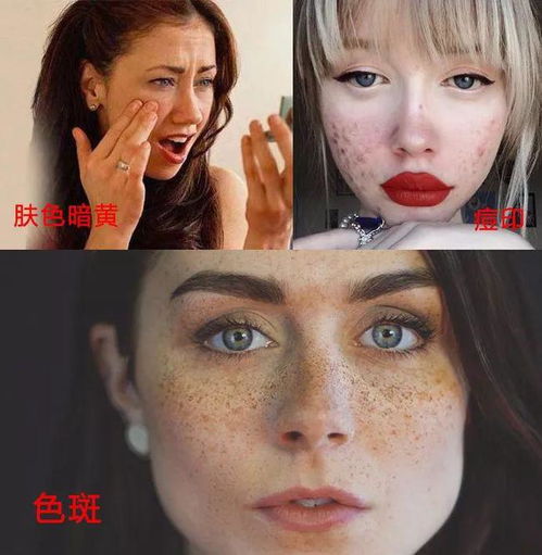 科学淡斑，安全焕颜 如何选择高效且安全的专业祛斑产品