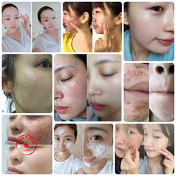 专业祛斑焕肤，守护敏感肌的健康与光彩——韩理泉护肤之道