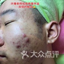 美丽新生，从“斑”驳到无瑕——探访荟草堂专业祛斑中心武汉二七店