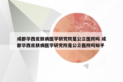 成都华西皮肤病医学研究院是公立医院吗 成都华西皮肤病医学研究院是公立医院吗