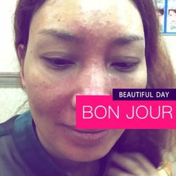 安庆瑶芳专业祛斑 科学护肤，焕发肌肤光彩