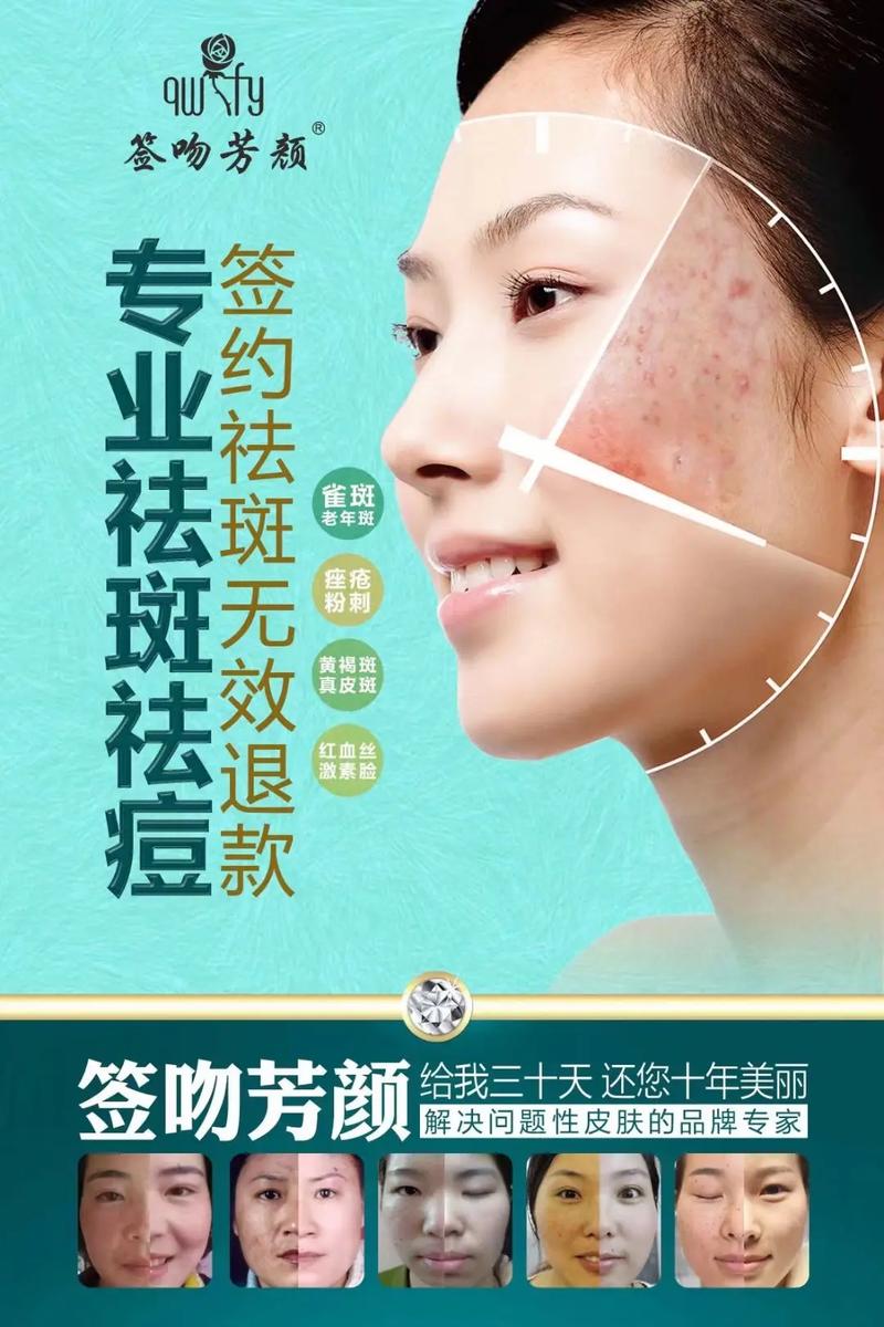 专业祛斑祛痘 纯中药绿色祛斑，二十多年成功经验