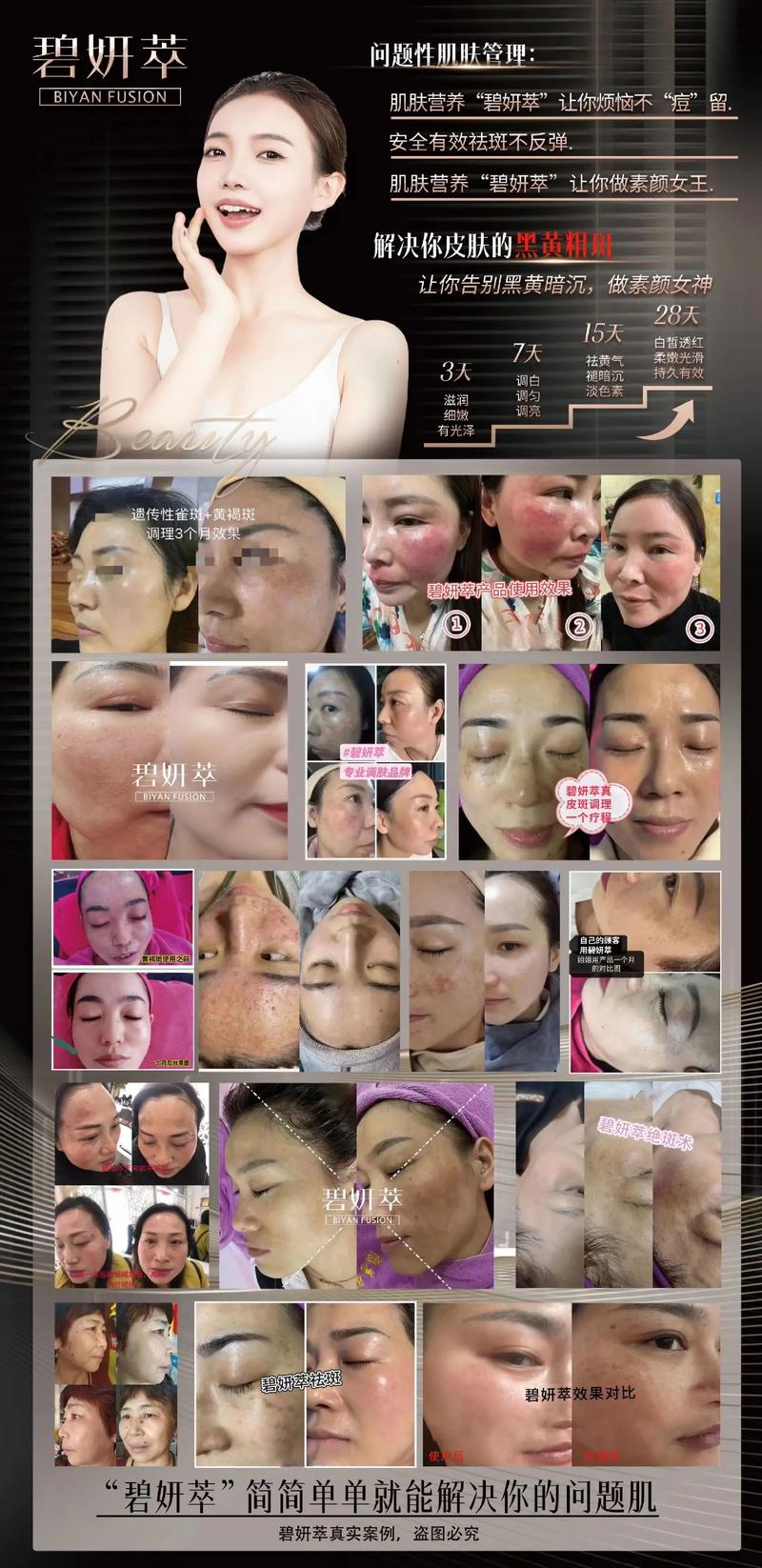 碧妍萃专业调肤祛斑 观其肤，辩其症，对症祛斑的最高境界